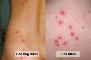 Bed Bug Bites and Flea Bites visual comparison