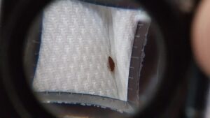 Bed Bug Magnified